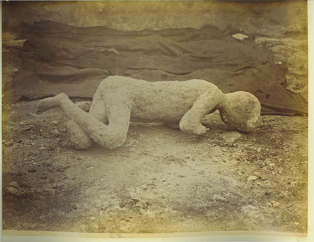 Calco A, described as “The Emaciated Child”, photographed by Giorgio Sommer in 1882. Photo courtesy of Eugene Dwyer.
Found in the Vicolo delle Pareti Rosse in front of VIII.5.39, the Casa di Acceptus ed Euhodia. 
Plaster-cast of a boy found on 24th January 1882, around 12 feet (4 metres) above the ancient ground level. 
Also found nearby was a skeleton of a woman, but only her arm was successfully cast. 
On her arm were two gold bracelets, and on her hand were two gold rings. 
It is conjectured that she was his mother, and that he was infirm and being helped from an upper window when the surge hit Pompeii.  
See Dwyer, E., 2010. Pompeii’s Living Statues. University of Michigan Press, pp. 98 to 103: the emaciated child, the eleventh victim.
See Notizie degli Scavi di Antichità, 1882, p.280: See BdI. 1884, pp. 126 sgg.
The cast was defined by the discoverers as “bambino infermo” [sickly child] because of the thinness and frailty of the little body.
A child aged between 6 to 12 years old, in the opinion of the discoverers.
Although referred to by the excavators as “fanciullo”, the sex is not definable.
The cast was destroyed in the bombing of 1943.
See Osanna, N., Capurso, A., e Masseroli, S. M., 2021. I Calchi di Pompei da Giuseppe Fiorelli ad oggi: Studi e Ricerche del PAP 46, p. 544, Calco A.

