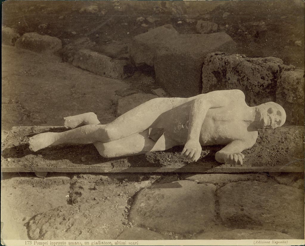 Calco B. Man resting on his left side, found 12th August 1889, outside the Porta Stabia. 
Photo by Esposito number 173 Pompei inpronto umano, un gladiatore, ultimi scavi. 
Kelsey Museum of Archaeology, University of Michigan Library Digital Collections 1961.07.0700.
See image on Kelsey Museum website 
Photo courtesy of Eugene Dwyer.
