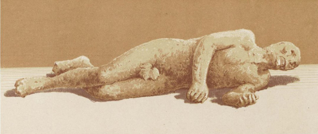 Calco B. Man resting on his left side, found 12th August 1889, outside the Porta Stabia. 
According to Niccolini,
A male completely nude, leaning on his left side, with the hands clenched: while the head has nothing but a horrible skull, all the body and especially the back was perfectly successful. 
See Niccolini F, 1890. Le case ed i monumenti di Pompei: Volume Terzo. Napoli. Tav. III, fig. 2.
A plaster cast of a fig leaf was added over the phallus when the cast of the victim was displayed in the Pompeii Antiquarium.
See Osanna, N., Capurso, A., e Masseroli, S. M., 2021. I Calchi di Pompei da Giuseppe Fiorelli ad oggi: Studi e Ricerche del PAP 46, p. 545, Calco B.

