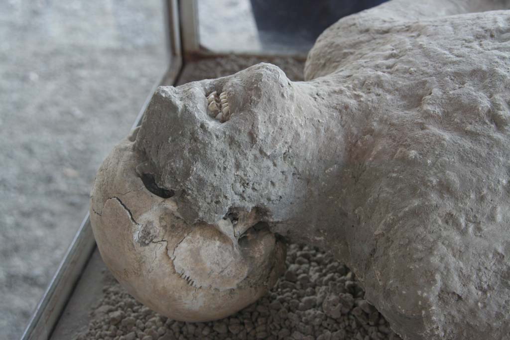 VII.9.7 and VII.9.8 Pompeii. April 2010. 
Detail of head of plaster cast of victim no.11, photographed in north-west corner of Macellum. Photo courtesy of Klaus Heese. 

