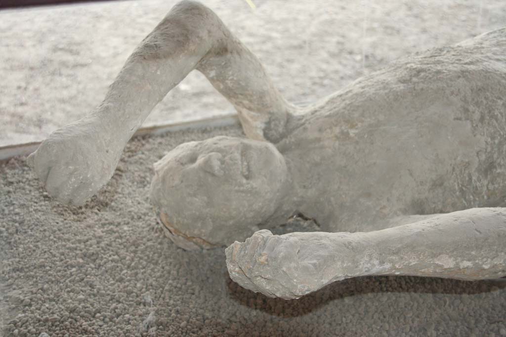 Victim number 14. April 2010. Detail of head and arms from plaster cast on display in north-west corner of Macellum.
Found near Stabian Gate. Photo courtesy of Klaus Heese. 

