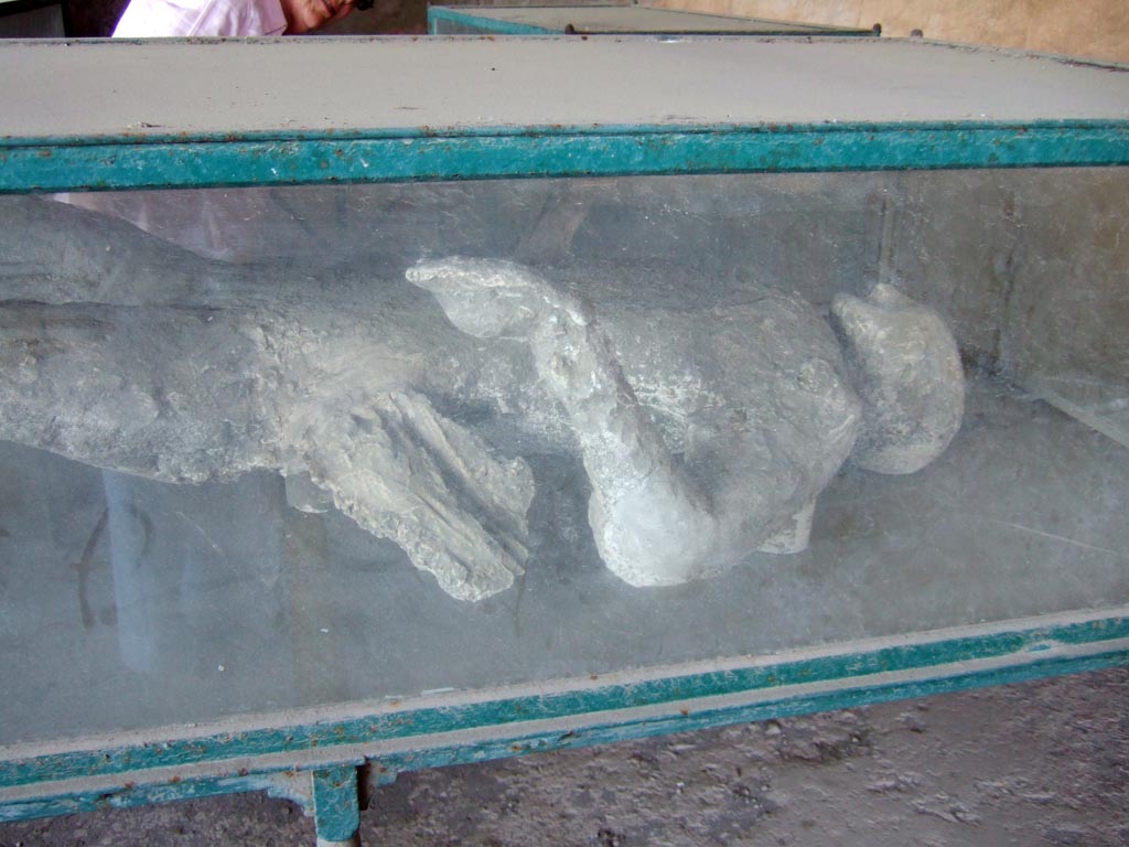 Victim 24. May 2006. Detail of plaster-cast of male victim number 24 on display in the upper loggia of I.6.2 Pompeii.
The victim was a male of adult age, over 20 years old.
The imprint of possible drapery adheres to the left side.
On the left hand the victim had an iron ring with a circular gem incised with a winged Vittoria holding a shield.
Under the abdomen was found an iron key, two rings perhaps belonging to a belt and a vague vase shape (baccellato) in vitreous paste.
See Osanna, N., Capurso, A., e Masseroli, S. M., 2021. I Calchi di Pompei da Giuseppe Fiorelli ad oggi: Studi e Ricerche del PAP 46, pp. 374-5.


