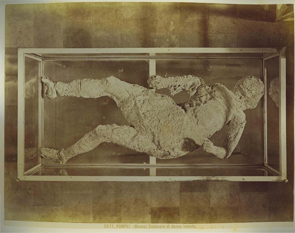 Victim number 4, photographed by Brogi, (no. 5577), described on the card as “The Pregnant Woman”, in a display case in the museum. 
Photo courtesy of Eugene Dwyer.
